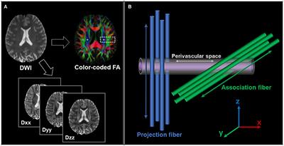 Water Diffusivity Changes Along the Perivascular Space After Lumboperitoneal Shunt Surgery in Idiopathic Normal Pressure Hydrocephalus